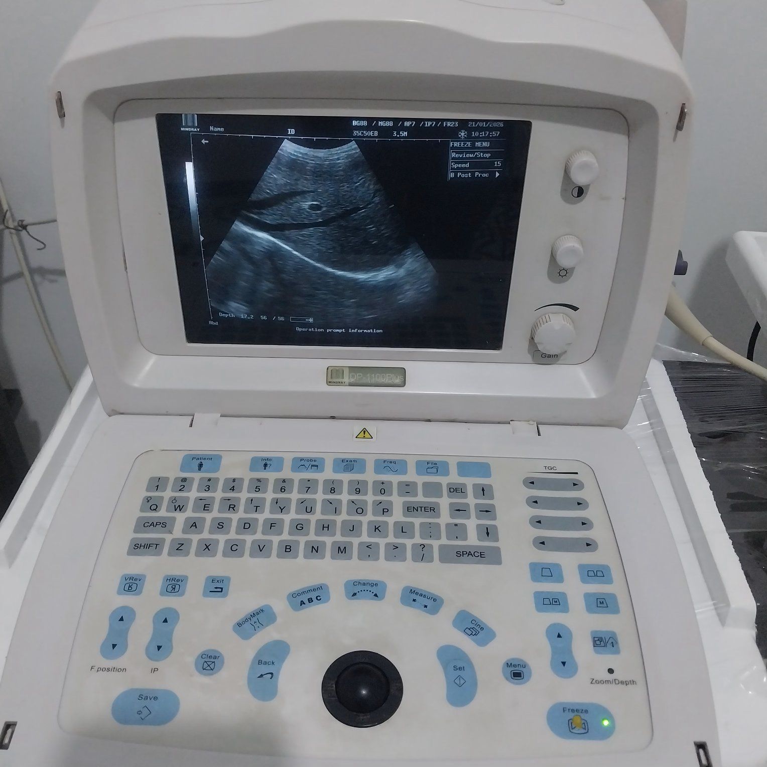 سونار Mindray Dp100plus