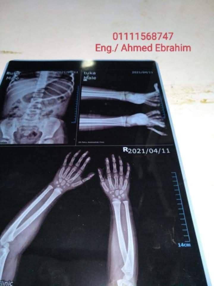 أجهزة طبية - صورة 2
