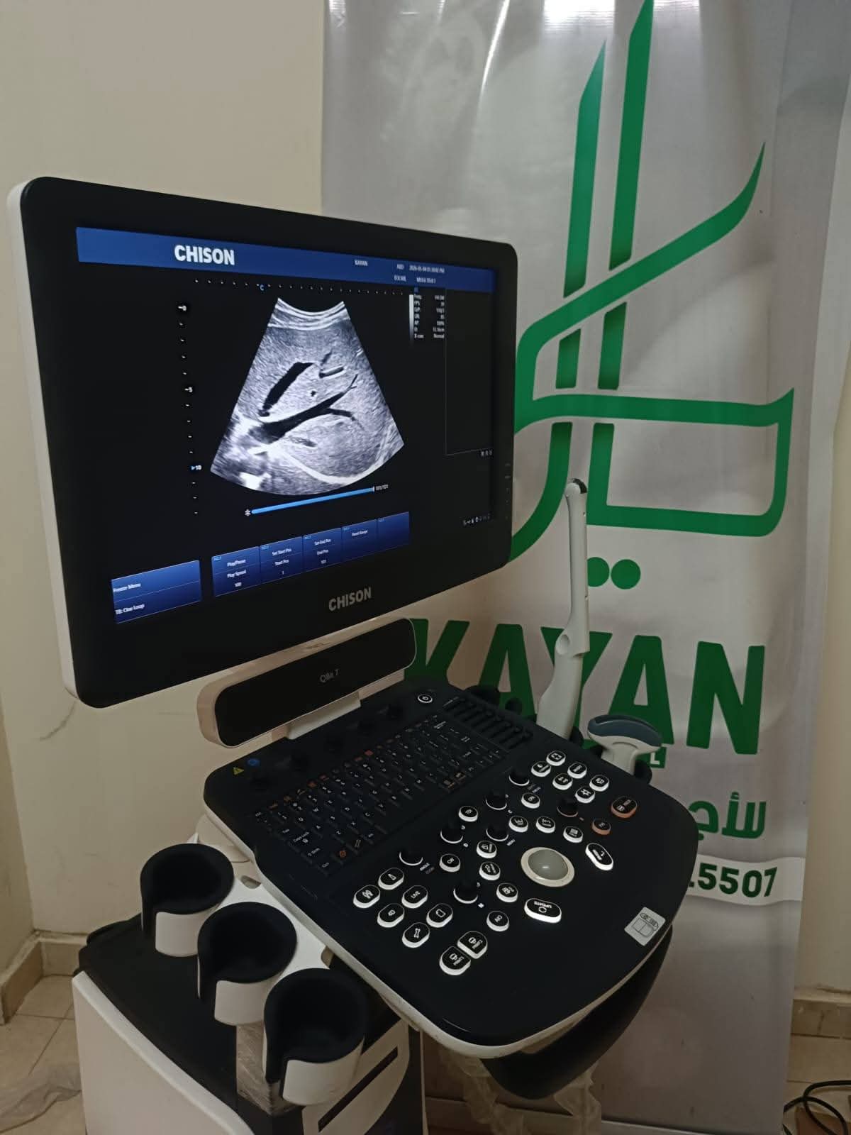 سونار - صورة 1