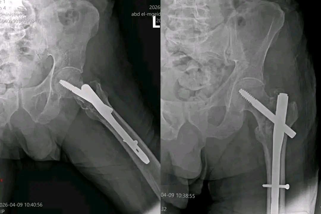 جهاز أشعة عظام - صورة 1